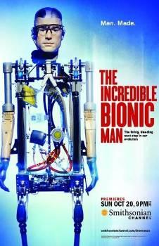 The Incredible Bionic Man / Невероятный бионический человек