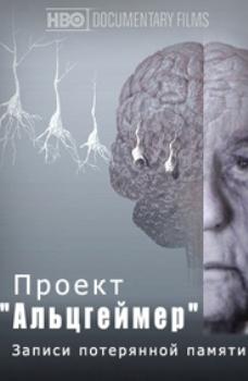 Проект "Альцгеймер"