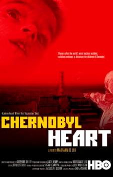 Чернобыльское сердце / Chernobyl Heart